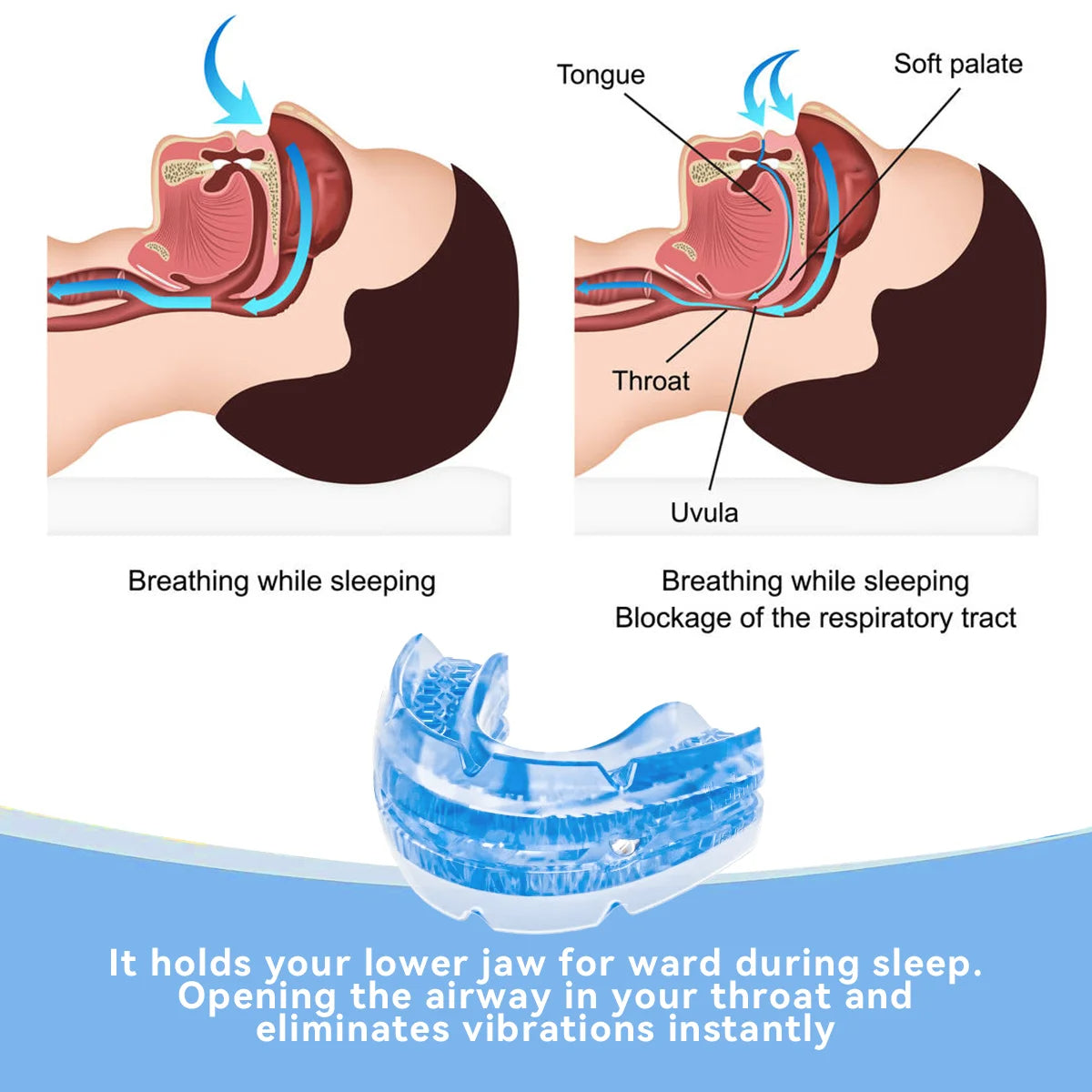 Adjustable Sleep Mouthpiece