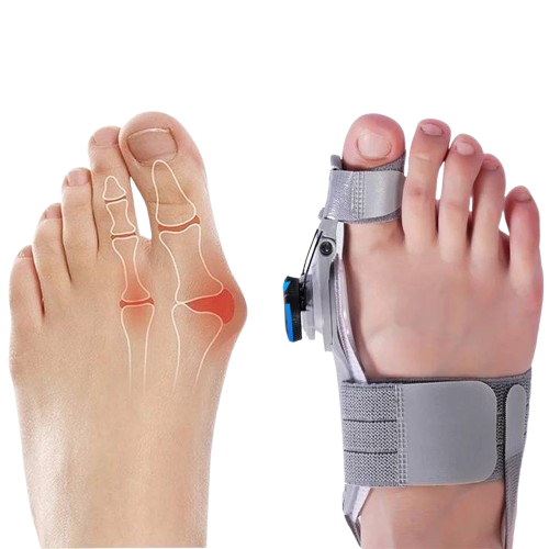 Adjustable Big Toe Separator with Hinged Support
